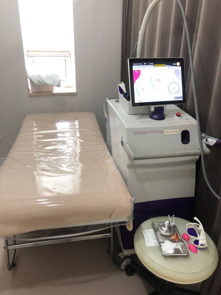 VBeam Laser for Rosacea at ReNewMe Skin Clinic